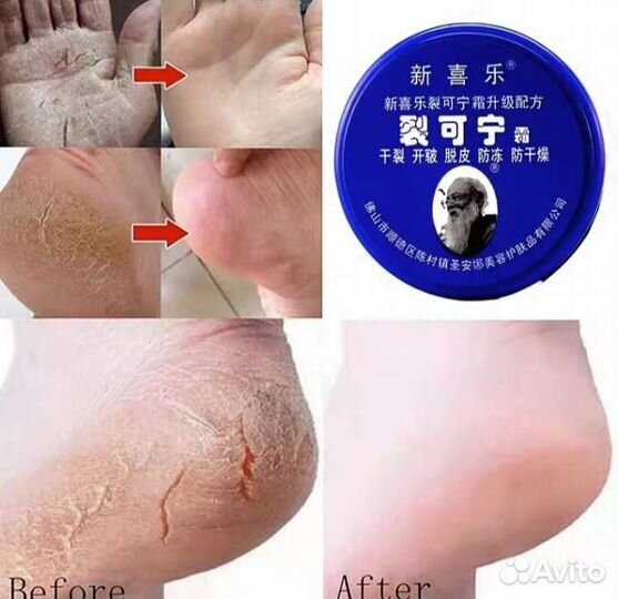 Крем от трещин и грубой кожи