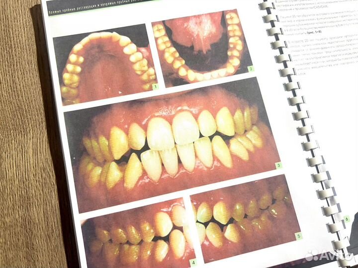 Современная эстетическая стоматология (полная)