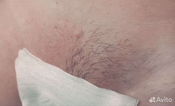 Шугаринг депиляция 8 кв