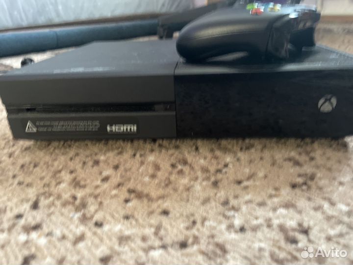 Xbox One limited edition