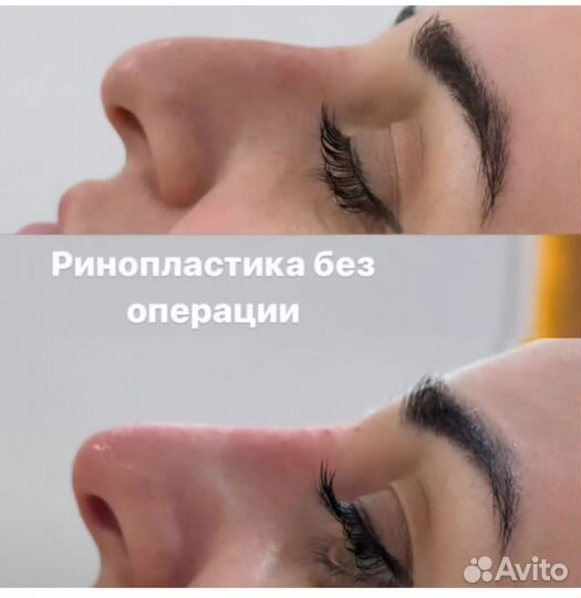 Услуги косметолога