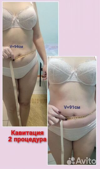 Аппаратная коррекция фигуры. Красивое тело