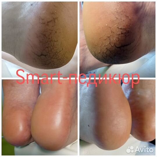 Мастер педикюра, подолог