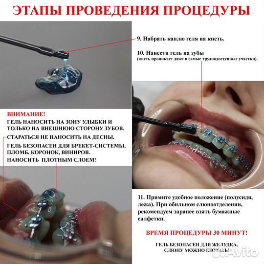 Домашнее отбеливание зубов