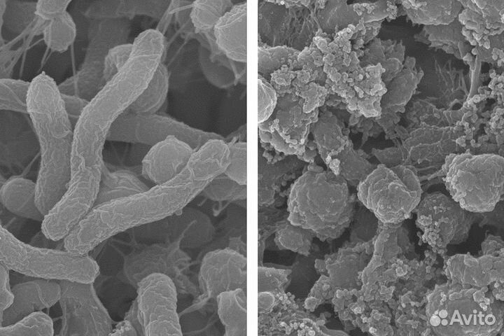 Пациенты на терапевтию