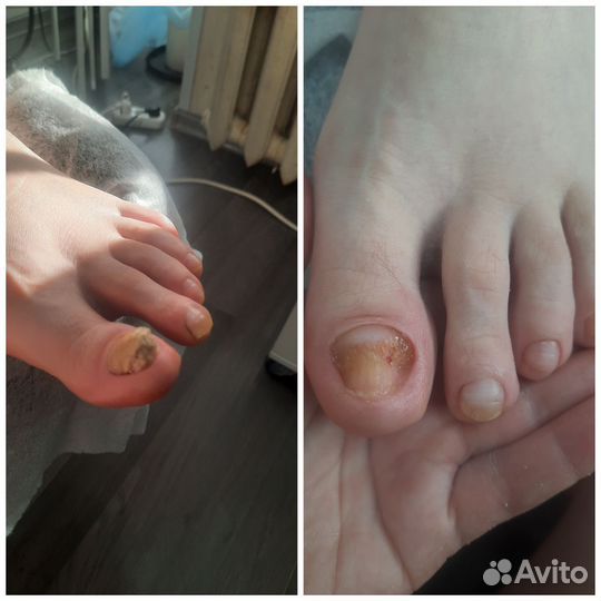 Подолог С мед. образованием, выезд на дом, педикюр