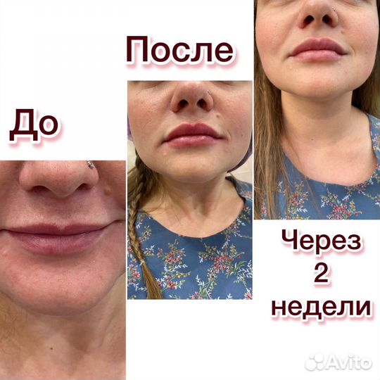 Услуги косметолога