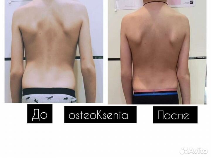 Оздоровление