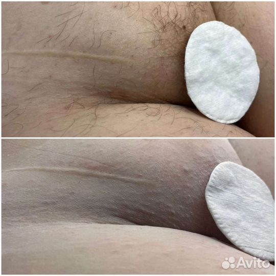 Мастер шугаринга