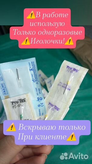 Электроэпиляция