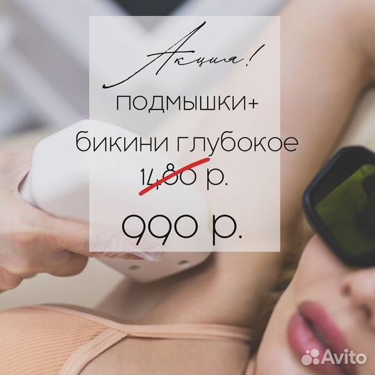 Лазерная эпиляция