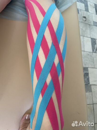 Тейпирование спины, суставов, лица