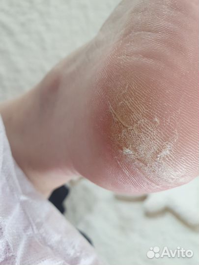 Педикюр, подолог Колтуши, Всеволожский район