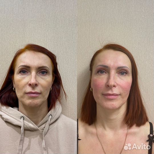 Обучение курсы массажа