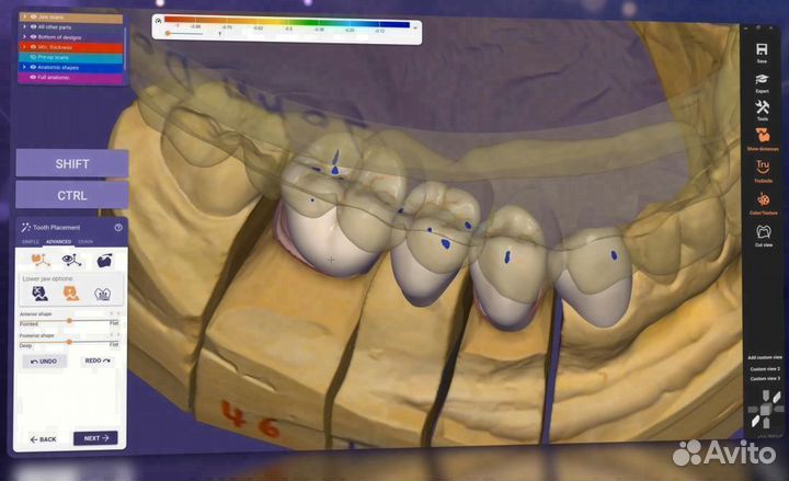 Hyperdent/3shape/ExoCad/Biblioteki Geo/PlastyCad