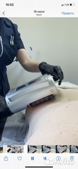 Аппаратный массаж, чистки косметолог