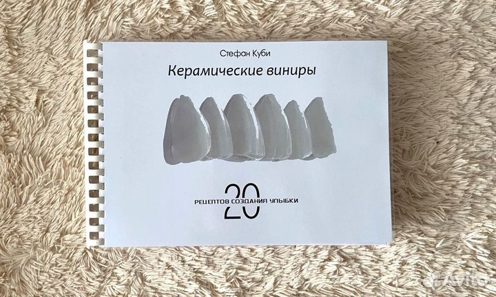 Керамические виниры