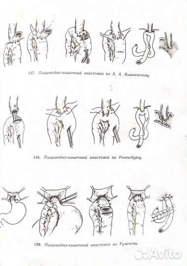 Атлас операций на пищеводе, желудке