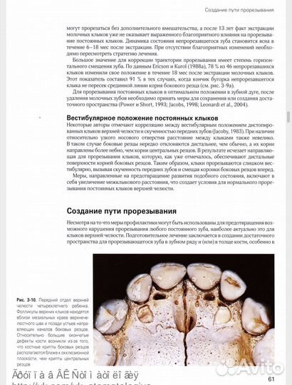 Хирургическое и ортодонтическое лечение ретинирова