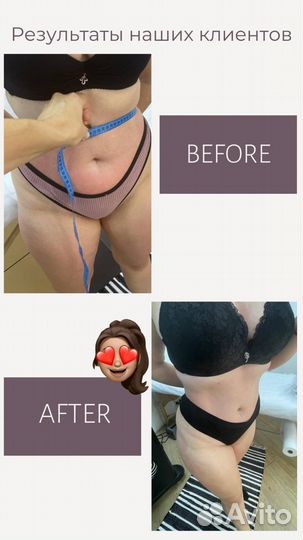 LPG массаж Антицеллюлитный