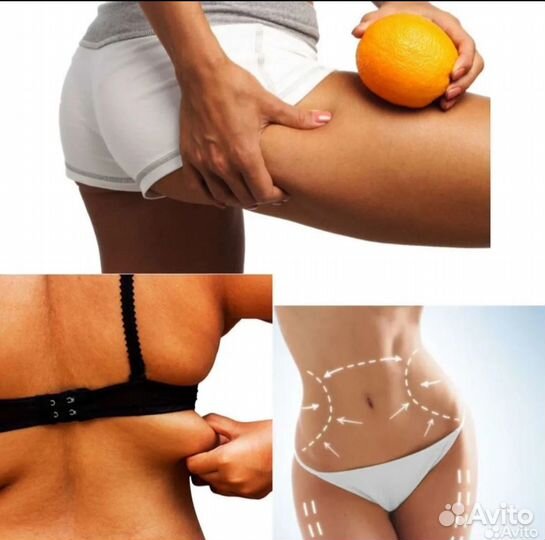 LPG массаж, косметолог- эстетист.12 квартал