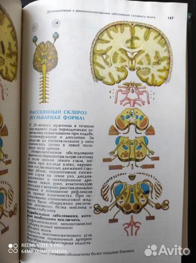 Книга по неврологии
