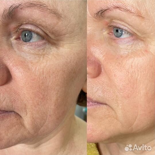 Косметик эстетист