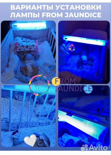 Уф лампа от желтушки