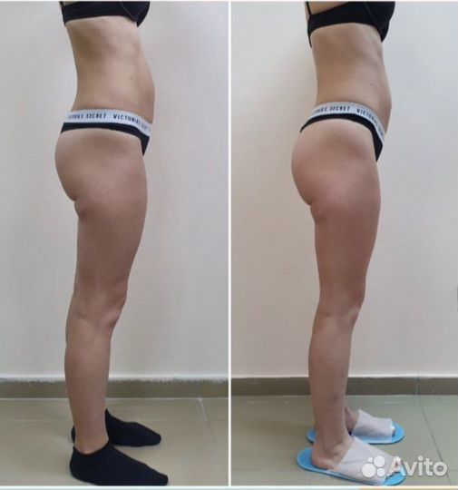 Похудеете аппаратный массаж Скетч