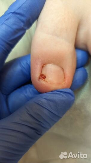 Подология, медицинский педикюр