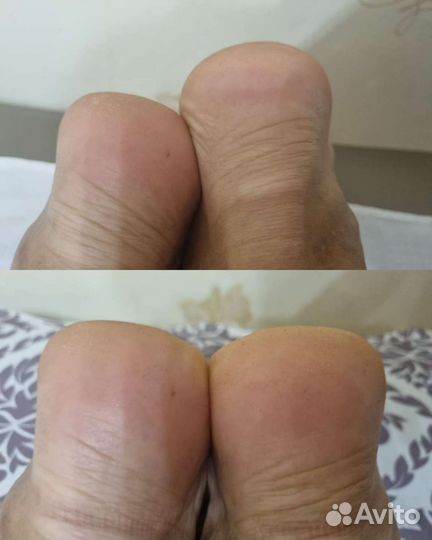 Массаж. Костоправ. Профессионал