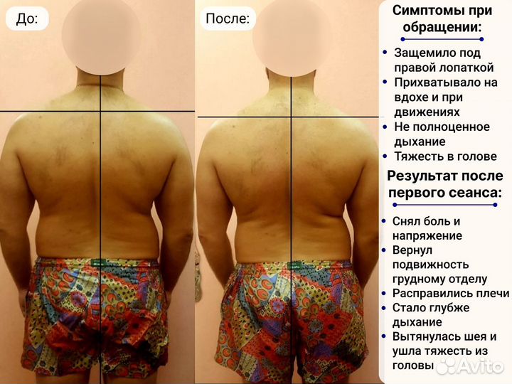 Мануальный массаж. Реабилитолог. Костоправ