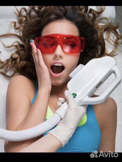 Лазерная эпиляция