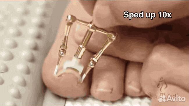 Приспособление от вросших ногтей Makizume Robo