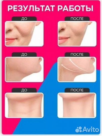 Аппарат для чистки лица (от акне)