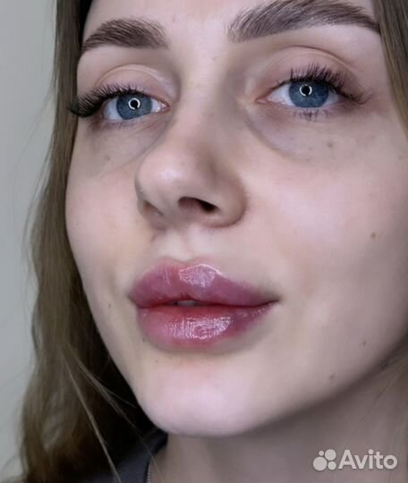 Увеличение губ