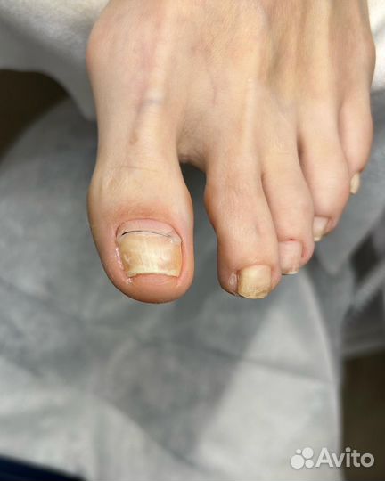 Подолог, маникюр, педикюр