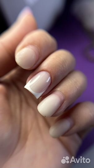 Модель на коррекцию гелем