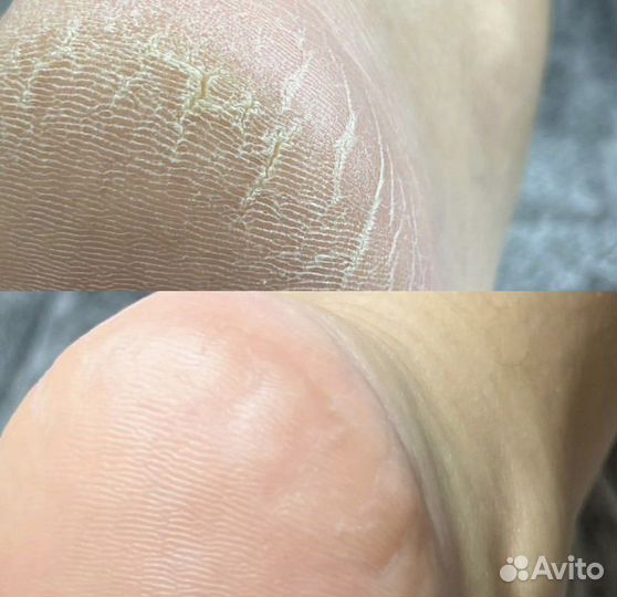 Педикюр (Fani Ben Ami)