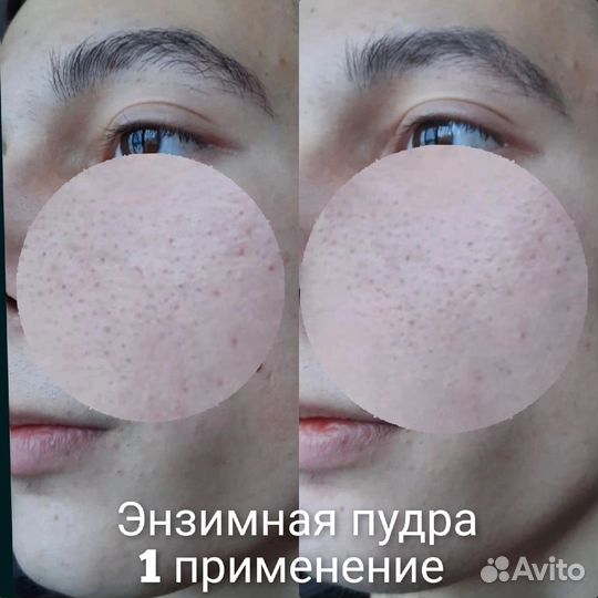 Энзимная пудра