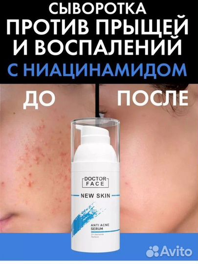 Сыворотка против прышей