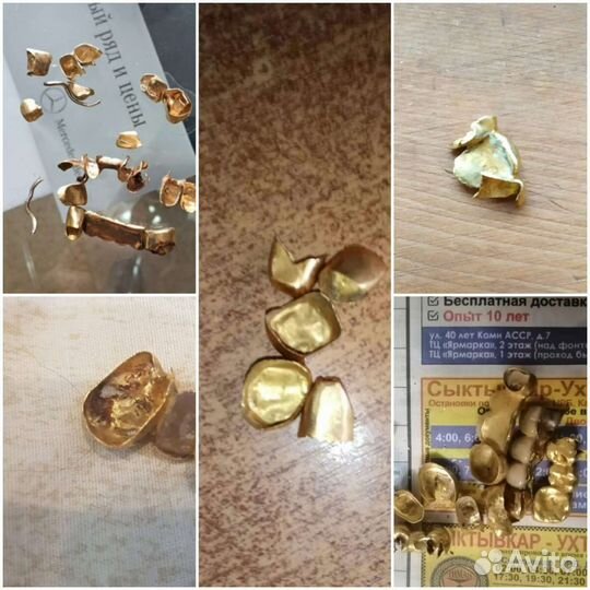 Золото серебро коронки