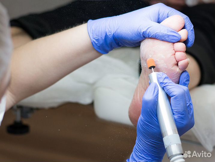 Медицинский (лечебный) педикюр - Подолог