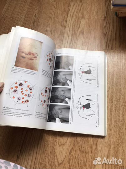 Медицинская книга семиотика