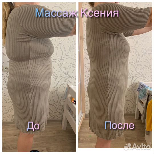 Аппаратная коррекция фигуры