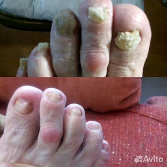 Мастер медицинского маникюра и педикюра с выездом