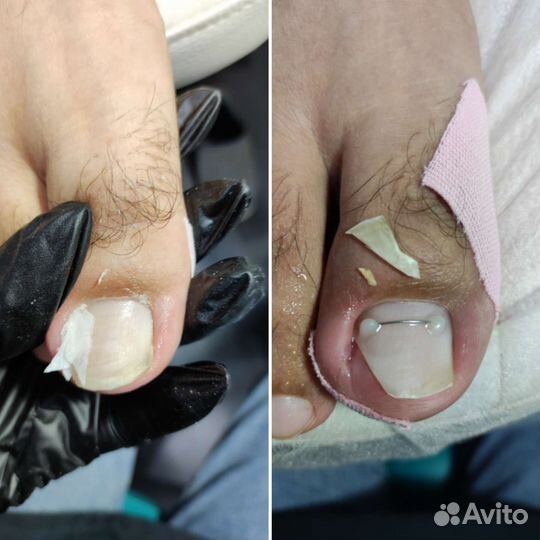 Услуги подолога