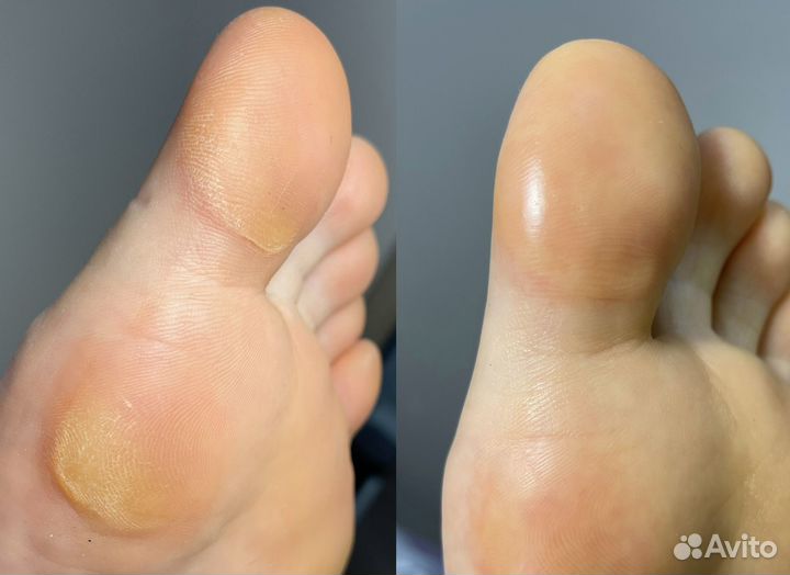 Маникюр / Педикюр / Гель лак