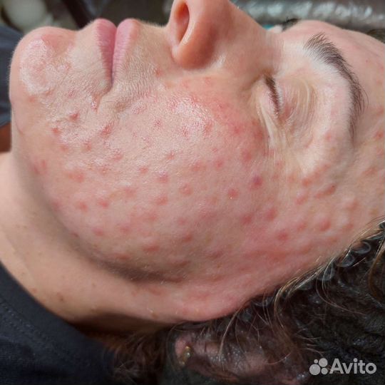 Услуги косметолога