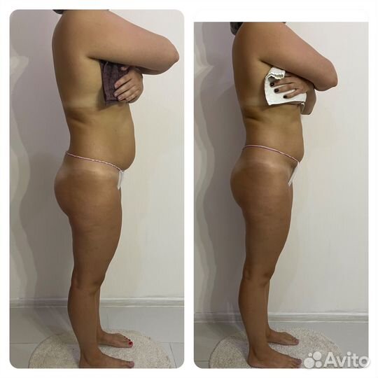 Аппаратный массаж